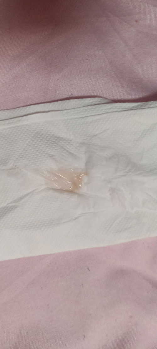 Keluar cecair ape dari faraj.. kandungan bru 5w..