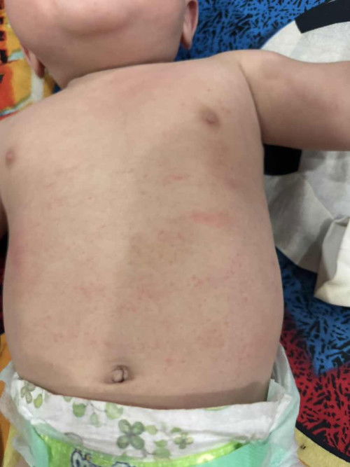 Bintik merah/ biji merah