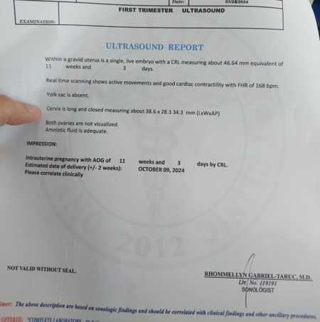 Yolk sac is absent