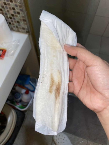Implantation bleeding po ba ito?