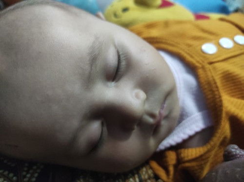 Bercak putih pada dahi