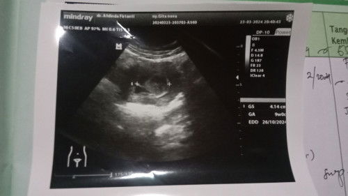 Mau tanya dong bun..