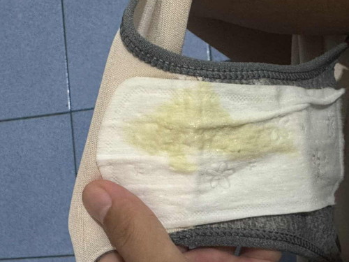 ตกขาวสีแบบนี้ปกติไหมค่ะ ท้อง 37+3w