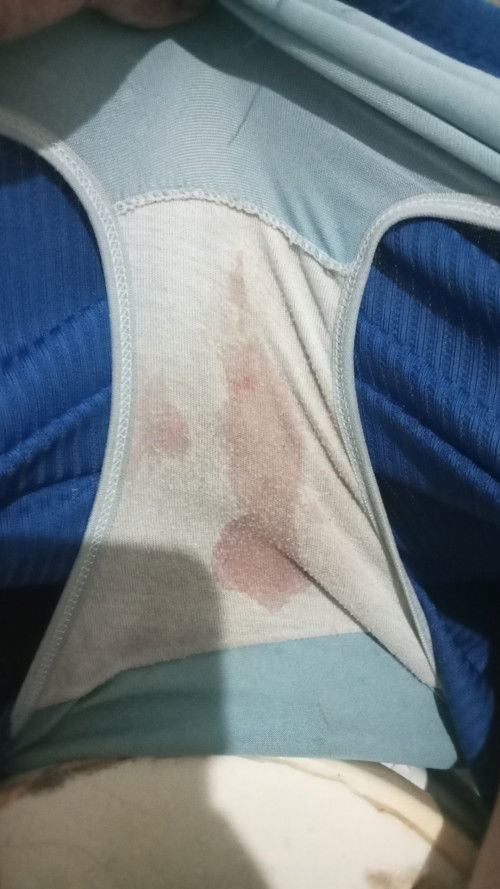 มีแม่คนไหนเคยเป็นบ้างค่ะ