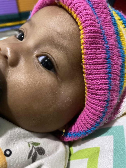 Bekas luka diwajah jdi putih