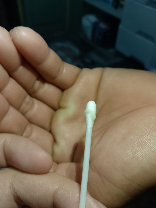 35weeks preggy and cs po ako.