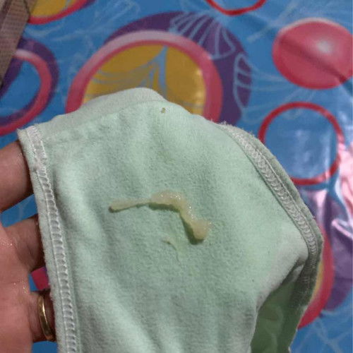 Hamil anak pertama usia kehamilan 40week 3day