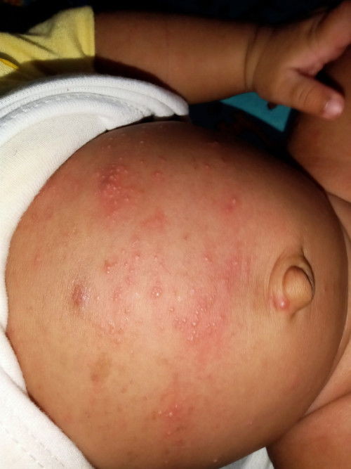 Ini bruntus atau apa ya bun ada yg pernah ngalamin?