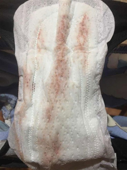 อยากทราบว่าน้ำคาวปลาจะหมดตอนไหนคะ