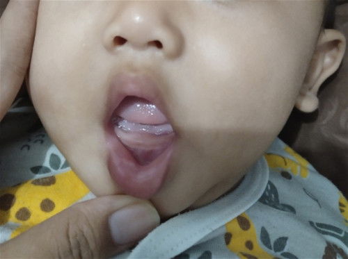 Awal mpasi dan tumbuh gigi