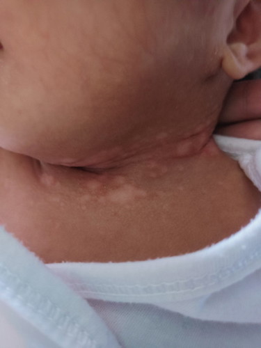 Ano po kaya itong nasa leeg ni baby?