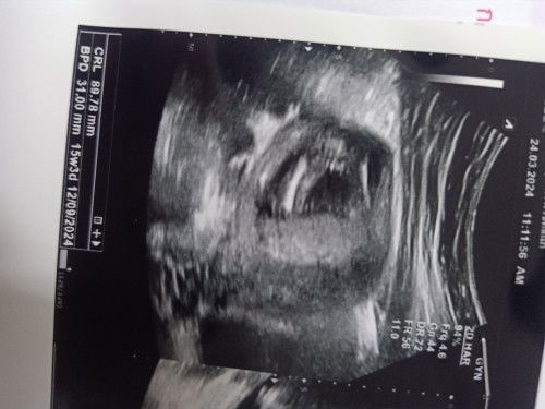 แม่ๆคิดว่าน้องเพศอะไรค่ะ