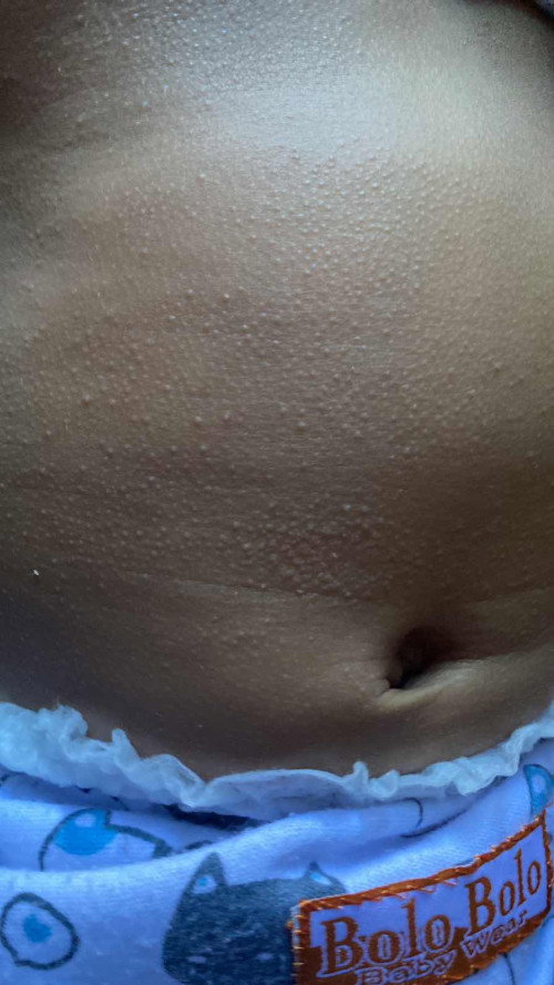 Badan anak bintik bintik