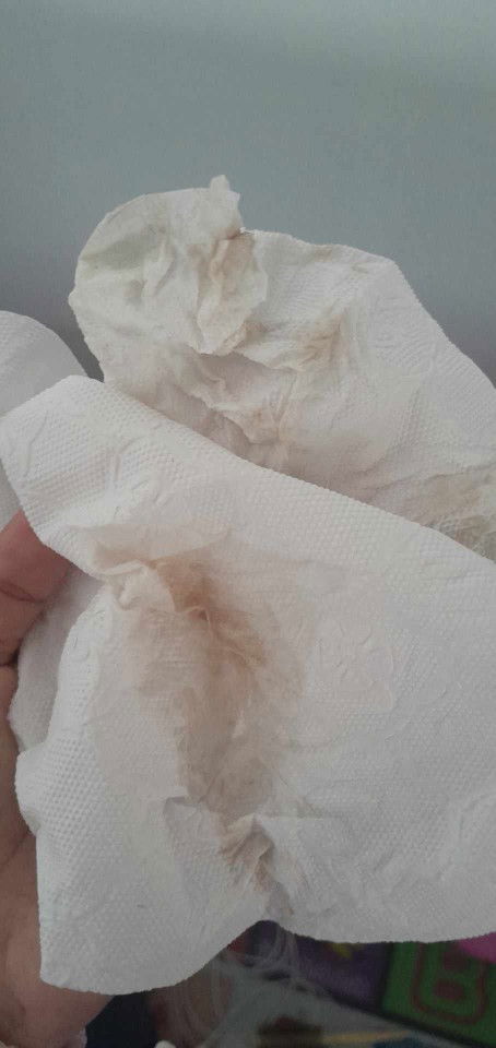 ภาวะแท้งคุกคาม