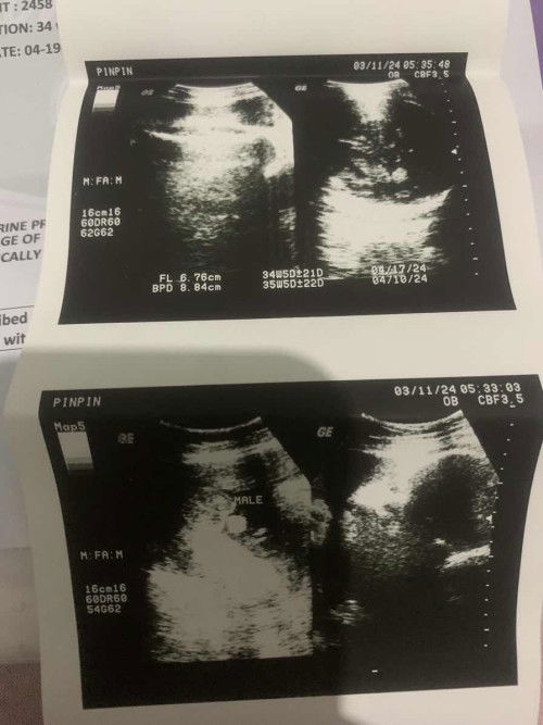 Ask kolang po Saan po dito yung head ni baby diko makita ksi e gender lang po nakikita ko😅😅😅