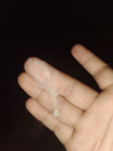 35+6
มีน้ำขาวๆไหลออกจากช่องคลอด