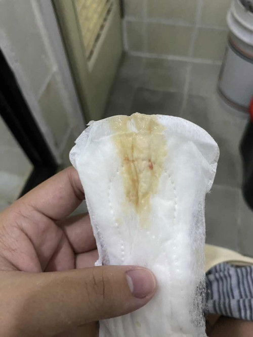 Discharge at 37 weeks