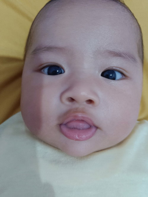 Mata bayi juling sebelah