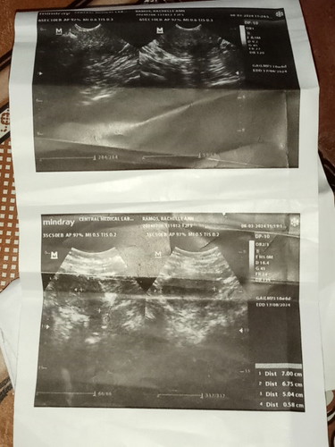Posible po bng buntis ako nyan o ndi pa poh?