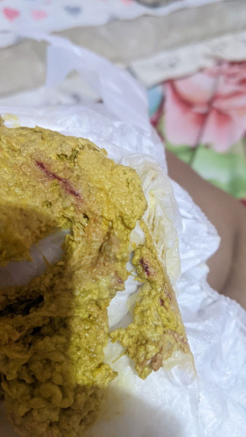 Bayi 1bulan pup ada darah sedikit