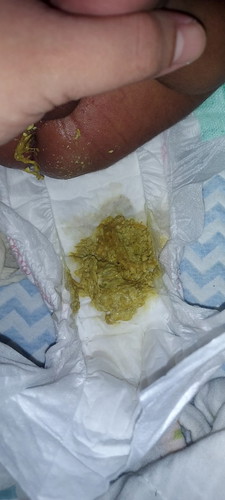 อึแบบนี้ปกติมั้ยค่ะ