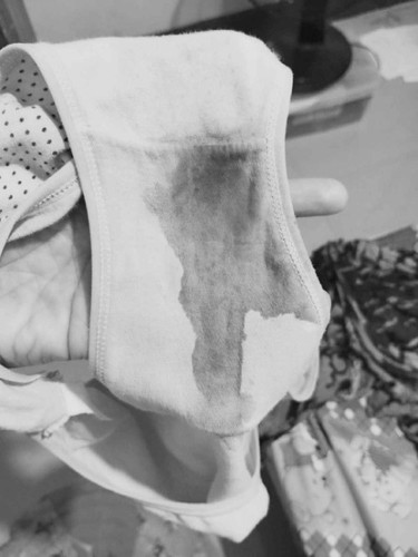 16 weeks pregnant, mga mommy me katulad ba aq d2 n may mild cramp s puson tpos me bleeding? 😔