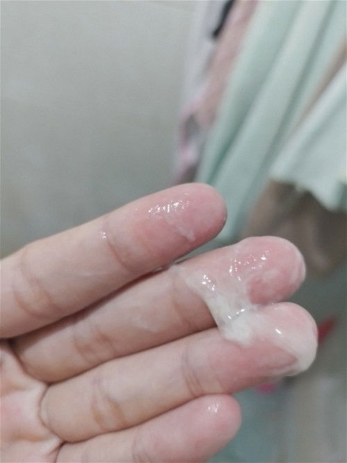 35+5 แบบนี้ตกขาวหรือมูกใสคะ