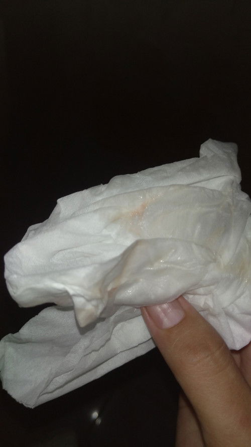 Keluar lendir tapi kontraksi blm intens