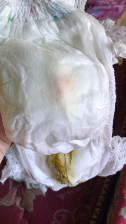 Bab dan Bak pada bayi