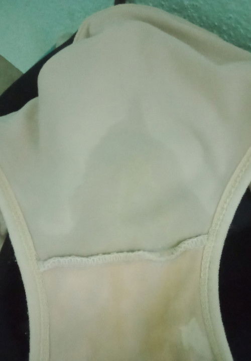 ท้องได้35+4 ค่ะ ขอบคุณสำหรับคำตอบจ้า