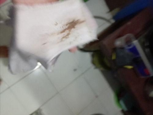 Flek dan keluar darah