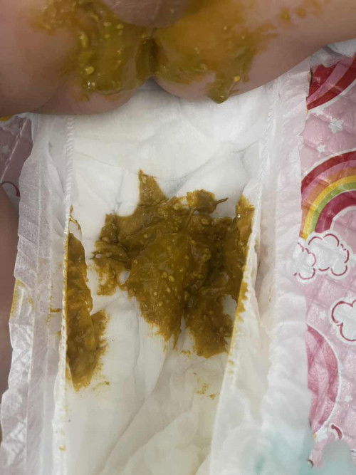 Tekstur dan warna Pup bayi