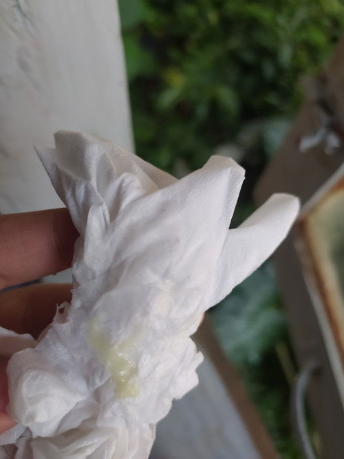 Maaf klo jorok,hamil 37w keluar lendir seperti itu kira" knp ya bun