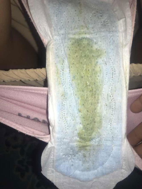 ขอสอบถามแม่ๆหน่อยค่ะ