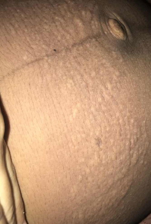 Gatel area prut sampe bentol2