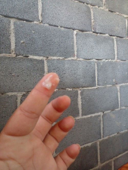 สอบถามให้แม่หน่อยค่ะตอนนี้ท้องได้ 37 + 6 วันแล้ว มีมูกใสๆแบบนี้ ใกล้ คลอดหรือยัง