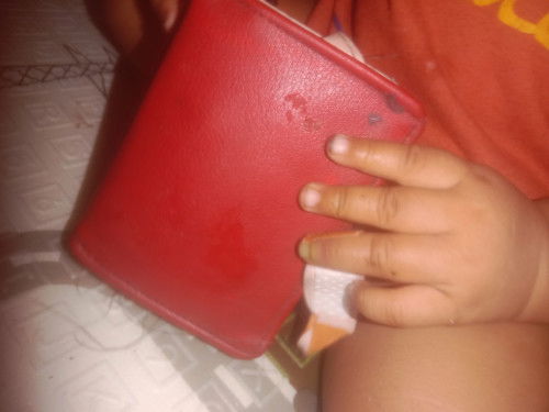 Bun obat/ salep buat anak kejepit pintu apa?