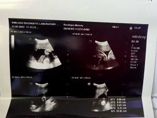 Healthy po ba si baby?