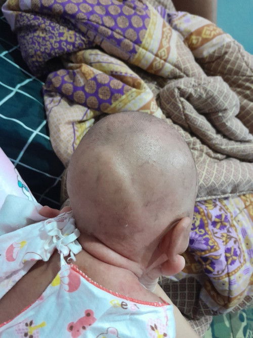 หัวลูก 1เดือน14วัน