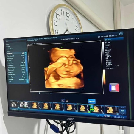ตัวแสบของแม่ 🫶🏻🤰🏼😍