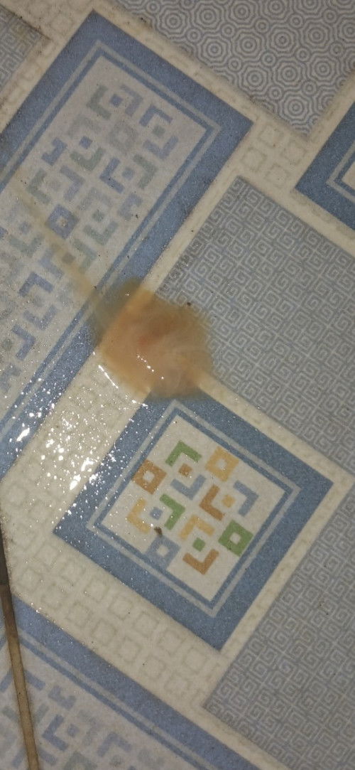 Flek setiap buang air kecil