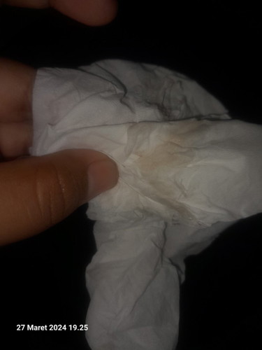 Kak ini termasuk flek atau keputihan sih hamil baru 5minggu4hari tolong bantu jawab ya kak makasih
