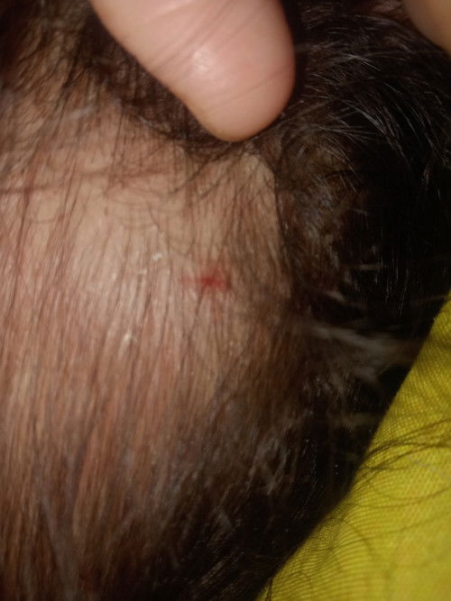 Jatuh terbentur di kamar mandi