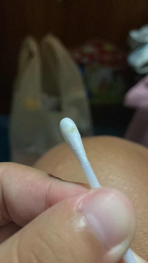 แบบบนี้มูกใสรึตกขาวคะแม่ๆๆหนูท้องแรกกไม่รู้เท่าไหร่37+3