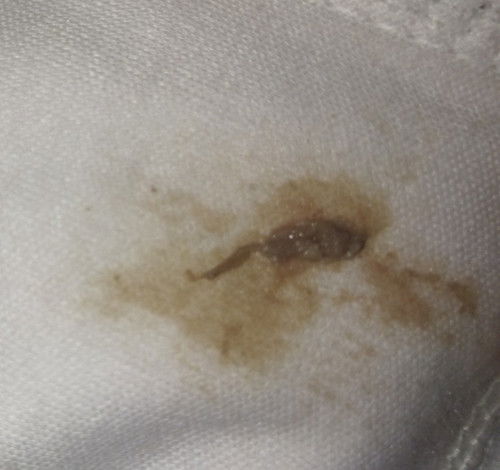 Hamil 4 minggu keluar flek