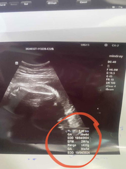 สอบถามแม่ๆเป็นความรู้หน่อยค่ะ🙏🏻🙏🏻