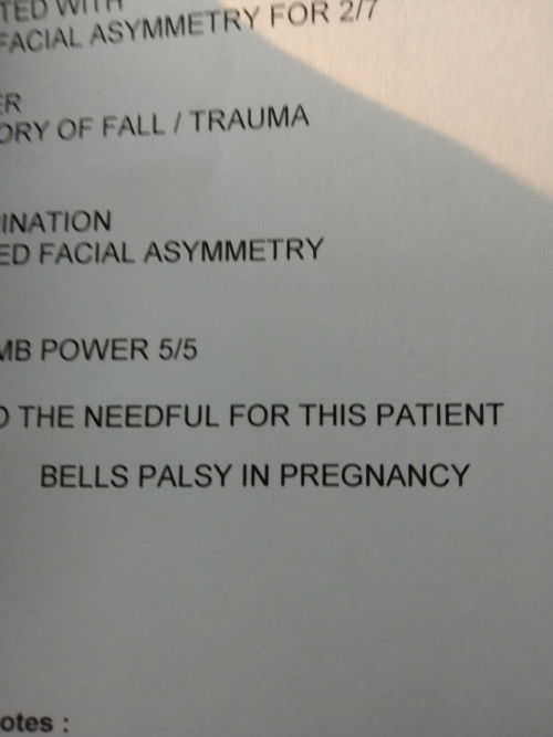 26hb saya di diagnosis Bells Pasly..