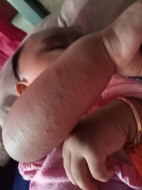 Tangan bintik-bintik merah