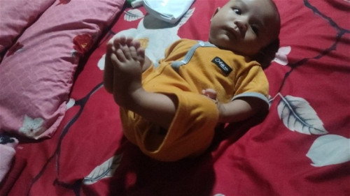Baby 3 bulan belum tengkurap