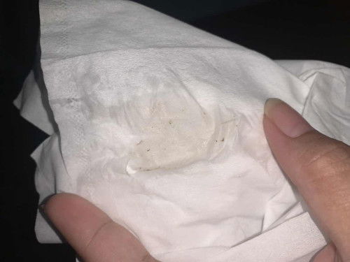 23w 4d flek sejak tgl 21 maret tapi gerakan janin aktif tiap hari